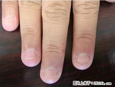 剪指甲、挖耳屎，这些日常小动作竟隐藏大危害！ - 六安生活资讯 - 六安28生活网 la.28life.net